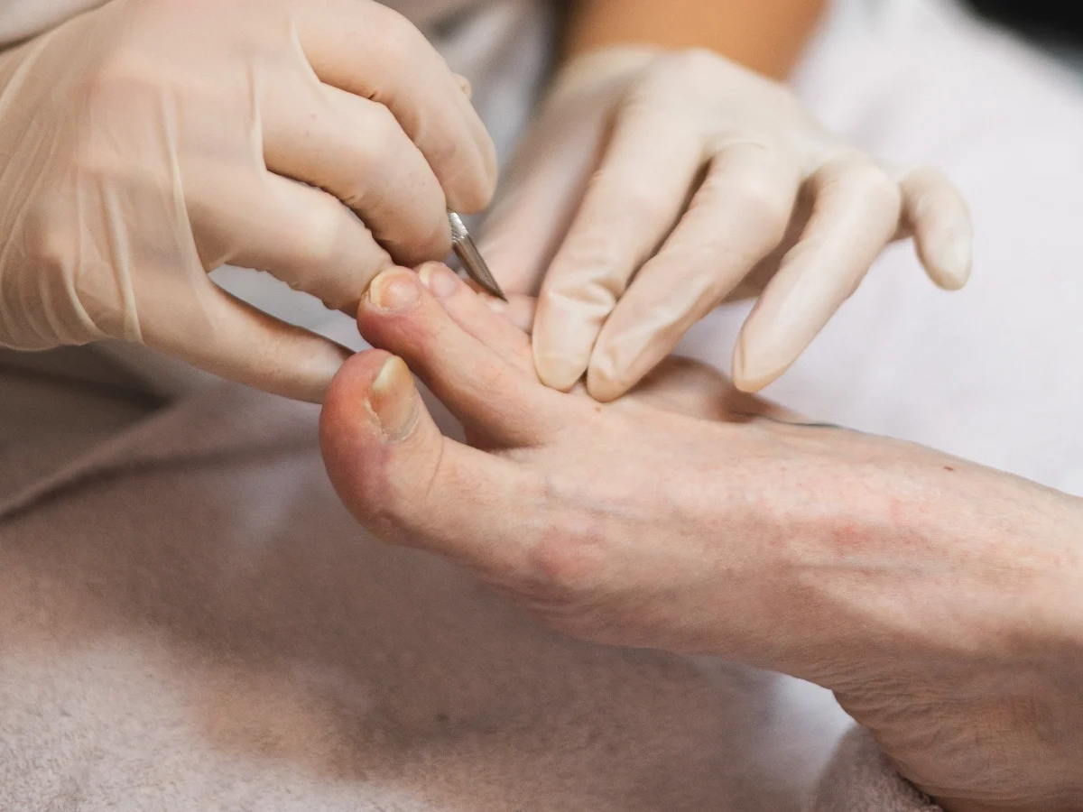 Strokovna pedikura v Postojni – urejeni nohti in nega stopal